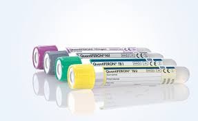 IDR et tubes pour IGRA